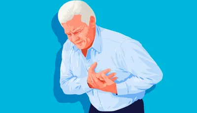 Ишемическая болезнь сердца (ИБС): симптомы, лечение, признаки
