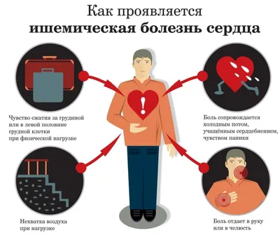 Ишемическая болезнь сердца: симптомы и лечение - Клиника в Уручье