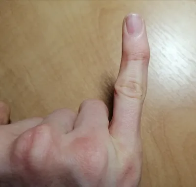 Фото рук с необычными пальцами