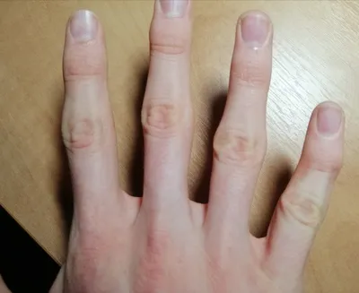 Искривленные пальцы на фото в формате JPG