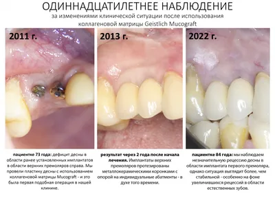 Однажды пациент сильно укусил меня за палец»: сколько зарабатывает детский  стоматолог