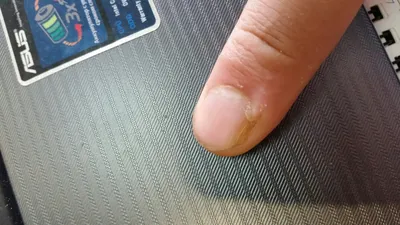 Фото руки с растущим ногтем