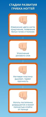 Фото грибка на ногтях рук: как не допустить его распространения