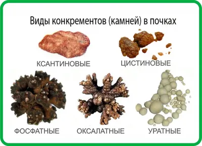 Vegapharm Tajikistan - Представляете камни, которые образуются в почках  бывают разными. Сейчас мы с вами разберём какие. Камни почек формируются из  разных солей и кристаллов. Существуют 3 основных вида: 1️⃣ Кальций  оксалатные -