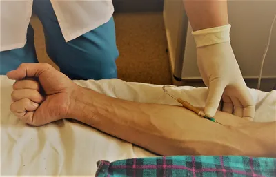 Капельницы в руке: фото для медицинских видео