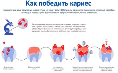 Лечение зубов у детей | молочные зубы и кариес у детей