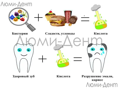 Кариес Зубов Что Это Такое 9 Причин Как Избавиться ЛюмиДент