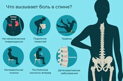 Симптомы опасности при боли, консультация в центре лечения боли в спине |  ТОНУС ЛАЙФ