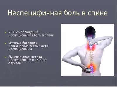 Боль в спине. Когда появляются антидепрессанты? - Painmed