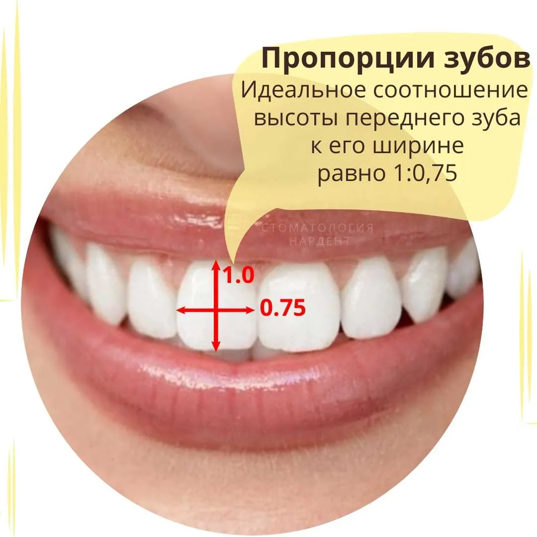 Какое расстояние между зубами. Идеальный размер зубов передних. Ширина фронтальных зубов.