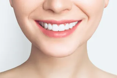 Как сохранить белоснежную улыбку после отбеливания зубов - Мои Родные
