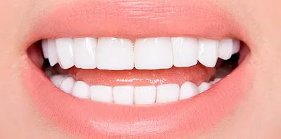 8 параметров идеальной улыбки, или Секреты красоты, о которых знают только  стоматологи | Стоматология ROOTT | Дзен