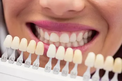Комплексное лечение зубов и потрясающий результат восстановления улыбки -  клиника \"Галерея Улыбок\"