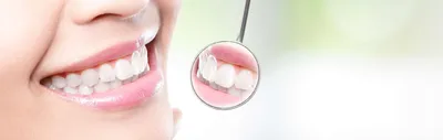 Улучшение эстетики улыбки с помощью виниров и коронок, имплантация и  лечение зубов - STOMARUS