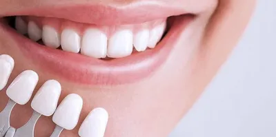 Улыбка с здоровыми белыми зубами, яркий красный состав конца-вверх  счастливая губ Забота косметологии, зубоврачевания и красоты Стоковое Фото  - изображение насчитывающей зубоврачевание, клиническо: 123128954