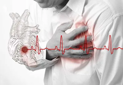 Человек Боль В Сердце Грудная - Бесплатное фото на Pixabay - Pixabay