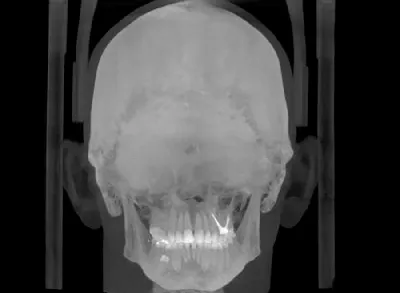 Модель черепа человека, анатомическая модель, медицинский череп,  анатомическая Анатомия человека, учебные принадлежности | AliExpress