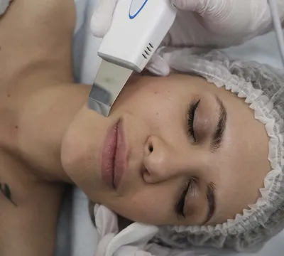 Чистка лица - заказать чистку лица в Киеве и Украине, выгодная цена на  чистку кожи лица в клинике косметологии Медлас