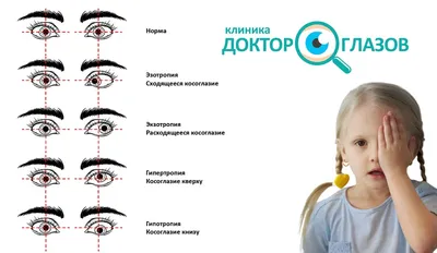 Лечение косоглазия у детей в Москве без операции