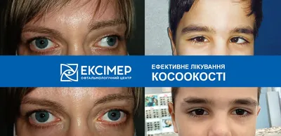 Операция по исправлению косоглазия, консультация специалиста | МЦ  Докторплюс, Сургут