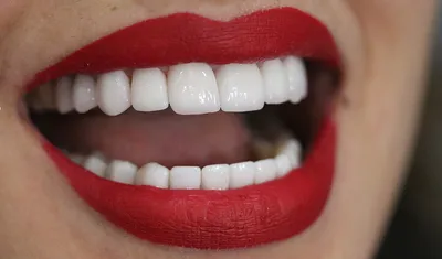 8 параметров идеальной улыбки, или Секреты красоты, о которых знают только  стоматологи | Стоматология ROOTT | Дзен