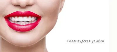 Лечение гингивальной улыбки ботулотоксином | Блог