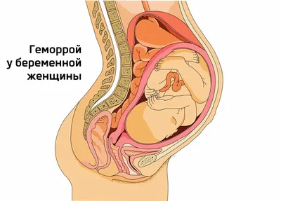 Мускусная мазь от геморроя (id 55760490), купить в Казахстане, цена на  Satu.kz