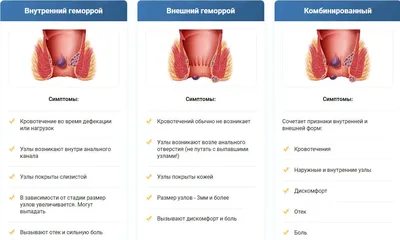 Свечи от геморроя быстрого действия ПРЕСТО ГЕЛЬ/ Ректальные суппозитории  PRESTO GEL Израиль (ID#1330284391), цена: 210 ₴, купить на Prom.ua