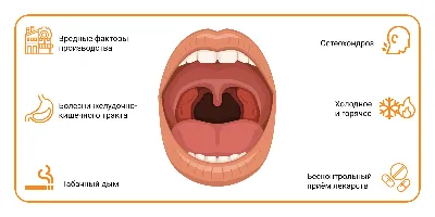 Воспаление горла, лечение, как выглядит, почему воспаляется горло — блог  Фурасол®