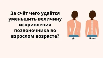https://onclinic.ua/ru/blog/vykryvlennya-khrebta-u-ditey-yakym-buvaye-ta-yak-yoho-likuvaty