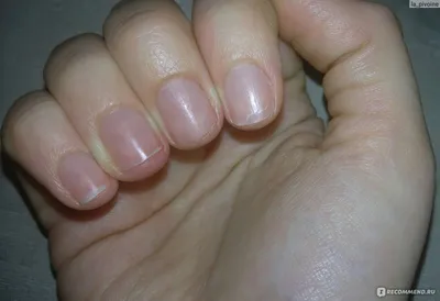Форма ногтей: какой дизайн лучше выбрать? (80 фото) | Нейл-арт, Ногти, Красивые  ногти