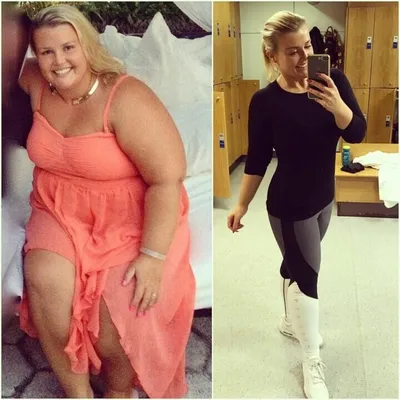 10+ фото женщин до и после похудения: мотивация перед летом!