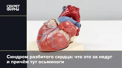 Разбитое Сердце — стоковая векторная графика и другие изображения на тему  Разбитое сердце - Разбитое сердце, Пара - Человеческие взаимоотношения,  Близость - iStock