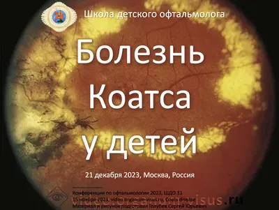 Лечение воспаления глаз у детей - консультация детского офтальмолога в  Екатеринбурге | Клиника микрохирургии \"Глаз\" им. Федорова