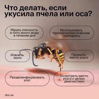 Что делать если укусила оса или пчела: первая помощь при укусе | doc.ua
