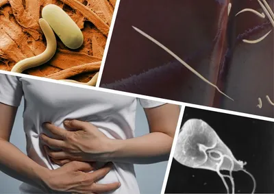 10 симптомов паразитов в организме человека и способы их устранения |  саквояж знаний | Дзен