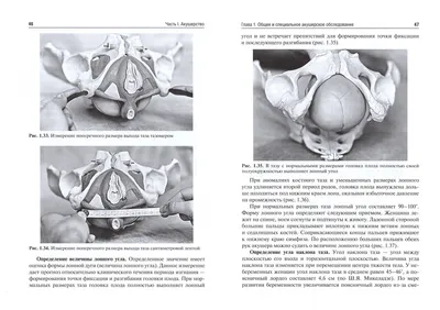 Иллюстрация 1 из 8 для Акушерство и гинекология. Практические навыки и  умения с фантомным курсом. Учебное пособие - Каптильный, Беришвили, Мурашко  | Лабиринт - книги. Источник: Лабиринт