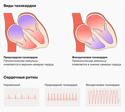 Пульс - RTS.Media