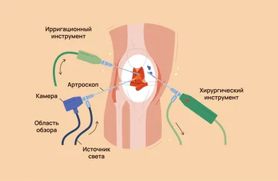 Ревматоидный артрит - диагностика и лечение по доступным ценам в Челябинске