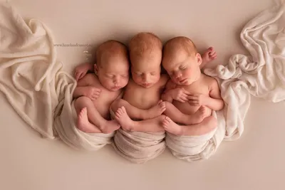 Один случай на 200 миллионов беременностей: гомельчанка родила трех  близняшек - 25.06.2023, Sputnik Беларусь