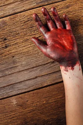 человек руки крови стоковое фото. изображение насчитывающей кровь - 15859840