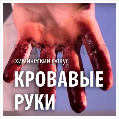 Раненая кровь отрезка руки стоковое изображение. изображение насчитывающей  кровь - 39612949