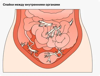 Емкость для украшений и красок 3 мл. Баночки для декора. Спайка  (ID#415472795), цена: 12 ₴, купить на Prom.ua