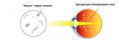 Купить Увлажняющий крем для лица и тела с церамидами для сухой и очень  сухой кожи, 340 мл CeraVe Увлажнение кожи: цена и отзывы - Увлажнение и  восстановление кожи - Центр Здоровья Кожи