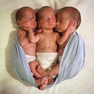 Идентичные тройняшки родились у 34-летней женщины из Нью-Йорка - фото