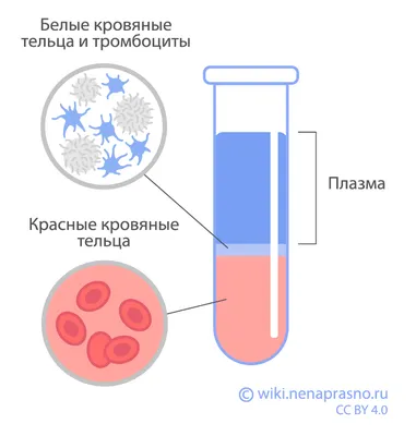 Капли крови запятнали раковину Кровь и стоки Splatter вертела в белой  раковине Стоковое Фото - изображение насчитывающей смерть, пакостно:  143535502