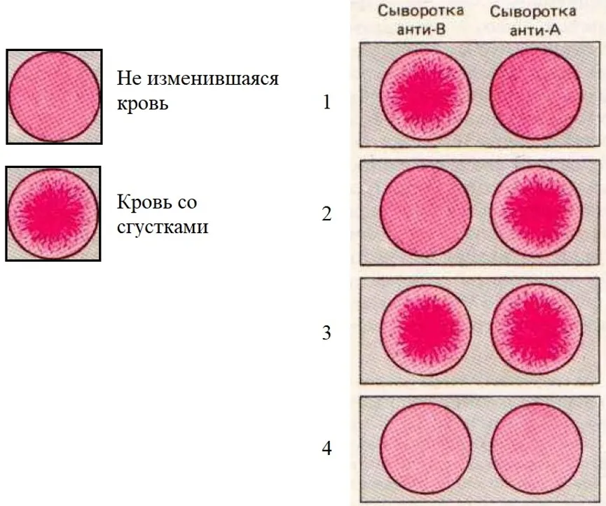 Явление при смешивании несовместимых групп крови. Антитела плазмы 1 группы крови. Цвета групп крови. Группы крови по системе ав0. 1. Группы крови по системе ав0..