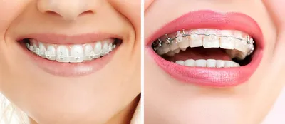 Что определяет понятие «здоровые и красивые зубы»? | Немецкая стоматология  доктора Гроссманна