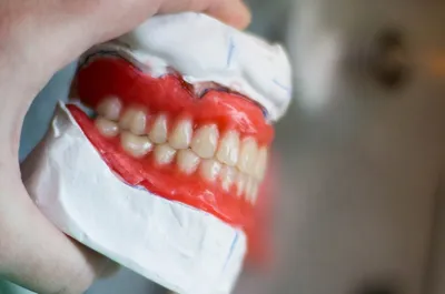 здоровые зубы с золотым блеском 3d визуализации на белом фоне для здоровья  зубов, зуб 3d, зубы 3д, зубной протез фон картинки и Фото для бесплатной  загрузки