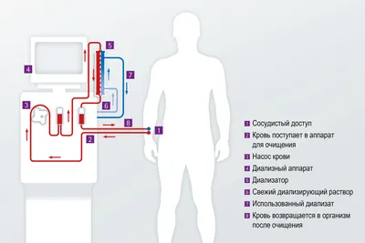 Катетер на руке: фото для блогов о здоровье